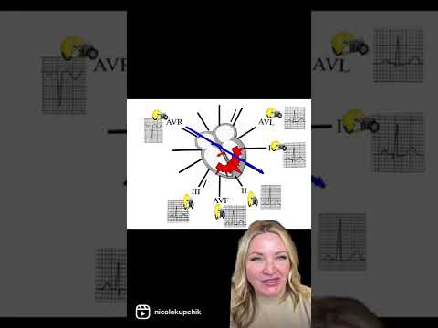 12 Lead ECG interpretation Part 1