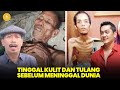 Miris Tubuh 8 Artis Ini Hanya Tinggal Kulit Dan Tulang Sebelum Meninggal Dunia
