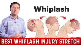 The Best Stretch Exercise To Do After Whiplash Injury – Dr. Berg