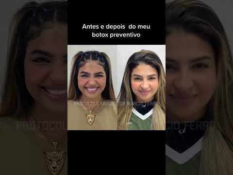 VOCÊS GOSTARAM ??? (#SHORT)