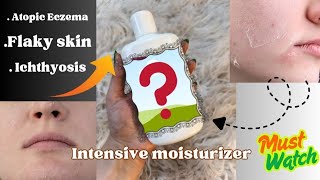 Moisturizer for Extremely Dry skin or Flaky skin