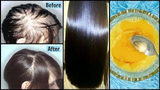 Powerful Remedy to Get Super Strong Hair | Stop Hair Fall in 1 Week | 100% EFFECTIVE