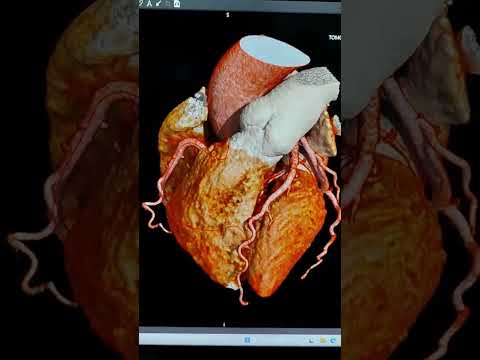 video BEn3lfRUy1g