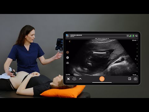 Femur Length Measurement