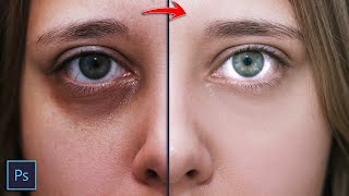 How To Remove Dark Circles Under Eyes In Photoshop (5 Min) | Frequency Separation | Non Destructive