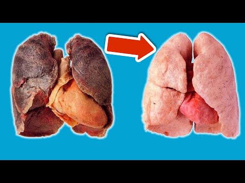 SO entgiftest und reinigst du deine Lunge 💥 (BESSER atmen in 7 TAGEN) 🤯