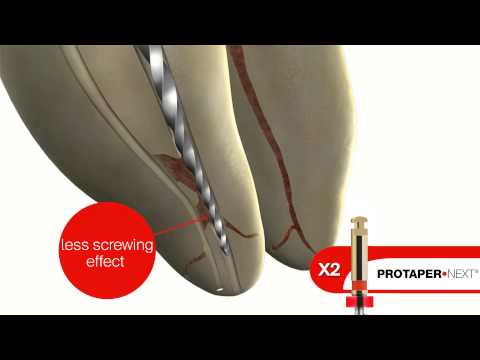DENTSPLY ProTaper Next
