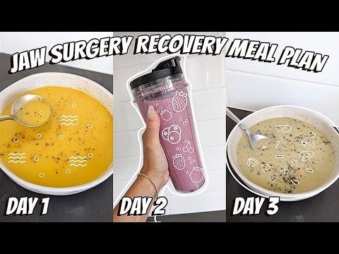 Jaw Surgery Recovery Meal Plan (HIGH PROTEIN LIQUID DIET!) Ep. 7