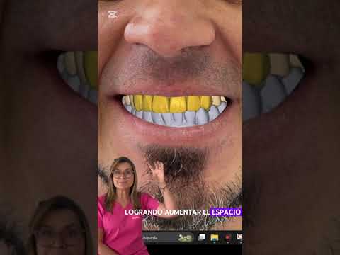 video BF8Dn0TCiAo