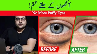 Dr. Zee:How to Get Rid of Puffy Eyes and Dark Circles | डॉक्टर ज़ी