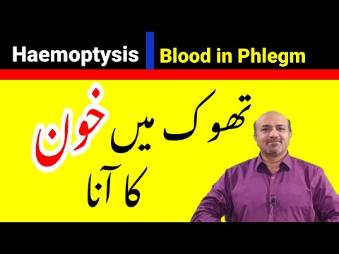 Haemoptysis Or Blood In Phlegm | Why We Have Blood In Phlegm | Thook Main Khoon | dr afzal