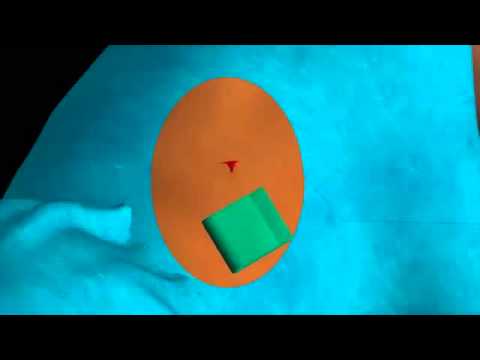 IPC  Pleural Insertion