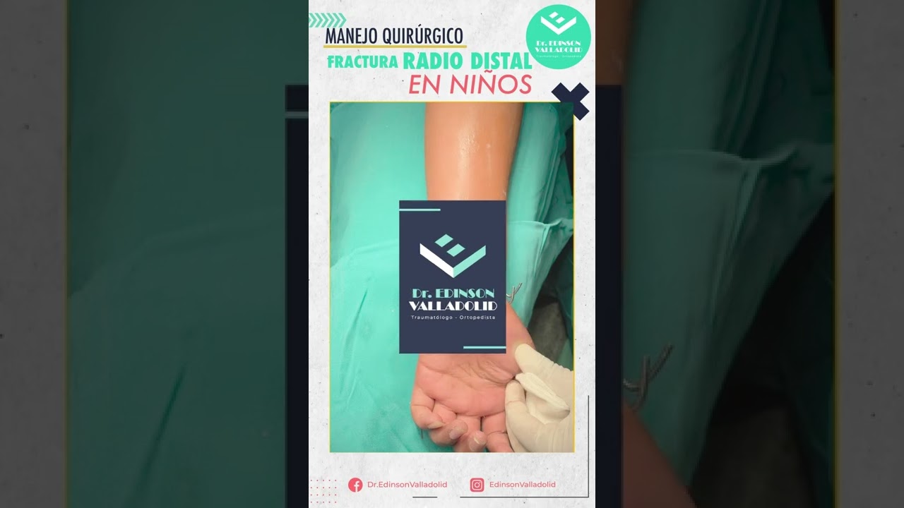 Edinson Valladolid Purizaga-18