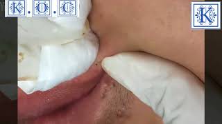 Sex photos in public