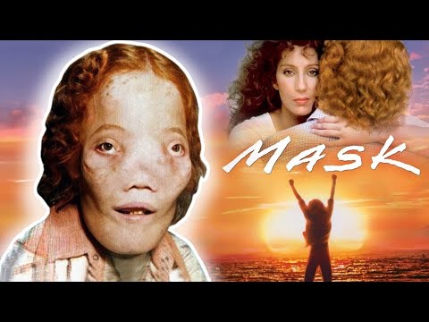 Rocky Dennis -- The Boy Behind The Mask