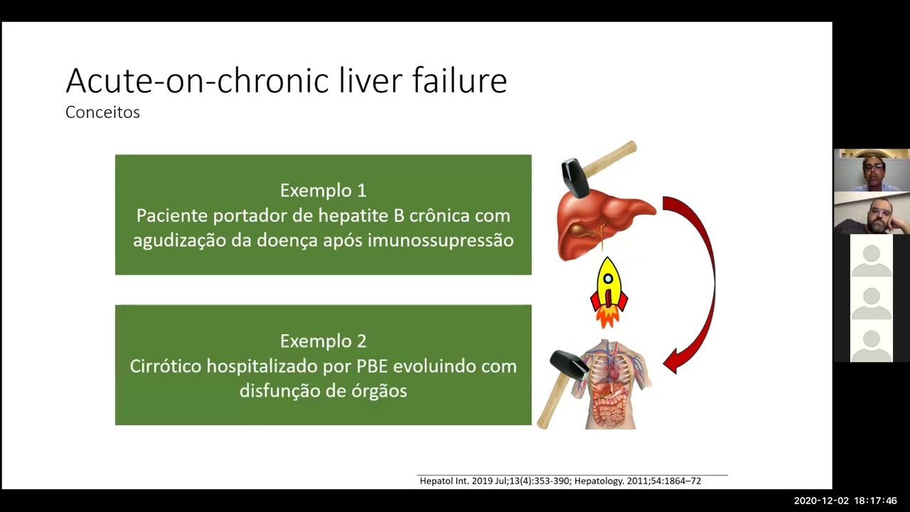 Aula paciente cirrótico na UTI