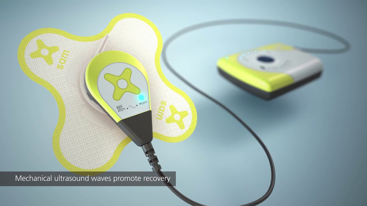 Sustained Acoustic Medicine (SAM 2.0) Mechanisms of Action