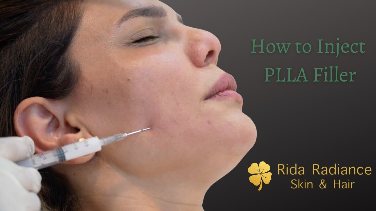 Rida Radiance treatment video 1