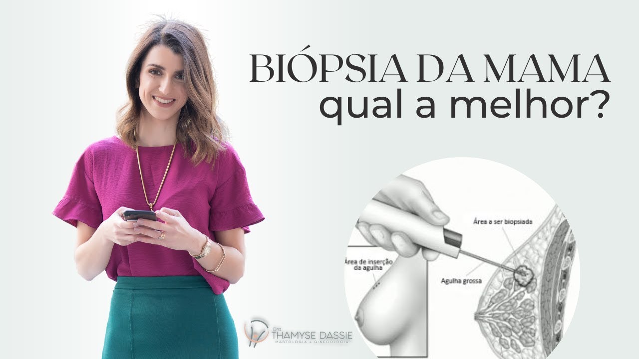 Quais são os tipos de biópsia da mama?