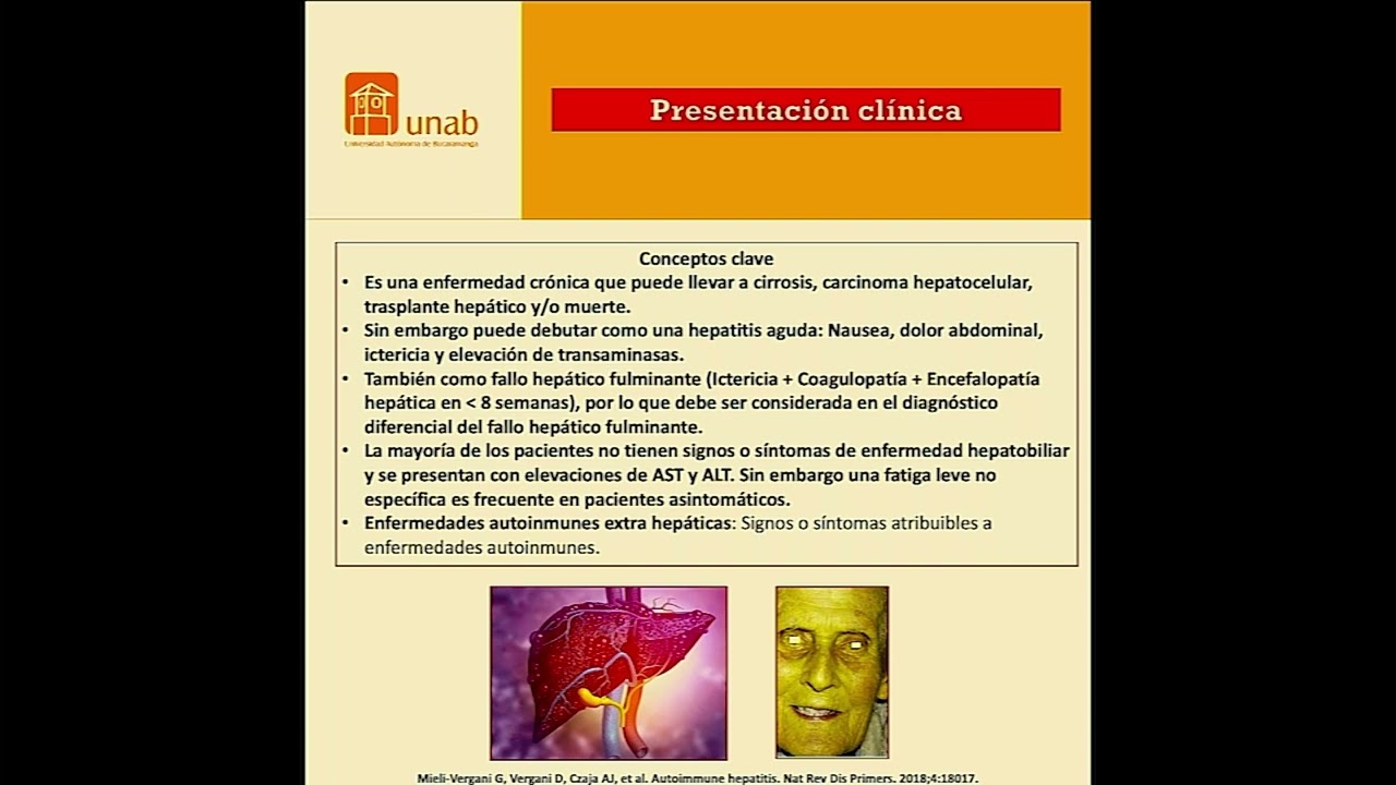 HEPATITIS AUTOINMUNE ACTUALIZACIÓN EN DIAGNÓSTICO Y TRATAMIENTO dr German Manuel Tovar fierro