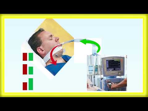 44   Proportional Assist Ventilation PAV