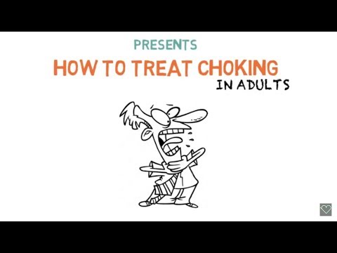 How to treat CHOKING in adults