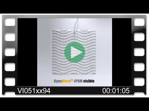 DynaMesh®-IPOM visible - Animation: 3D Reconstruction