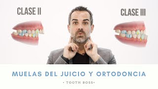 TOOTH BOSS || ¿Extraer las muelas del juicio antes de una ortodoncia || Ortodoncia en Murcia
