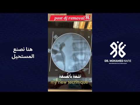 هنا نصنع المستحيل