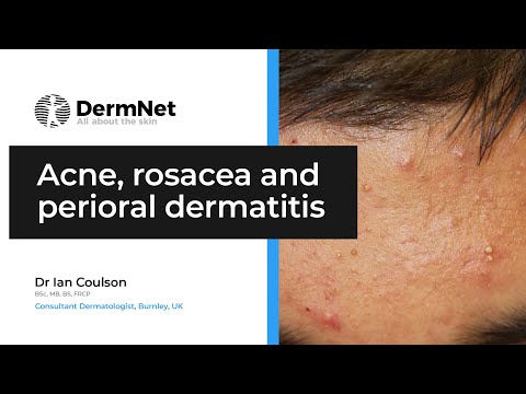 Acne, Rosacea, and Perioral Dermatitis