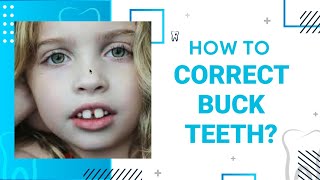How to Correct Buck Teeth https://www.straightsmilesolutions.com/