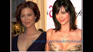 Catherine Bell Plastic Surgery   Before and After