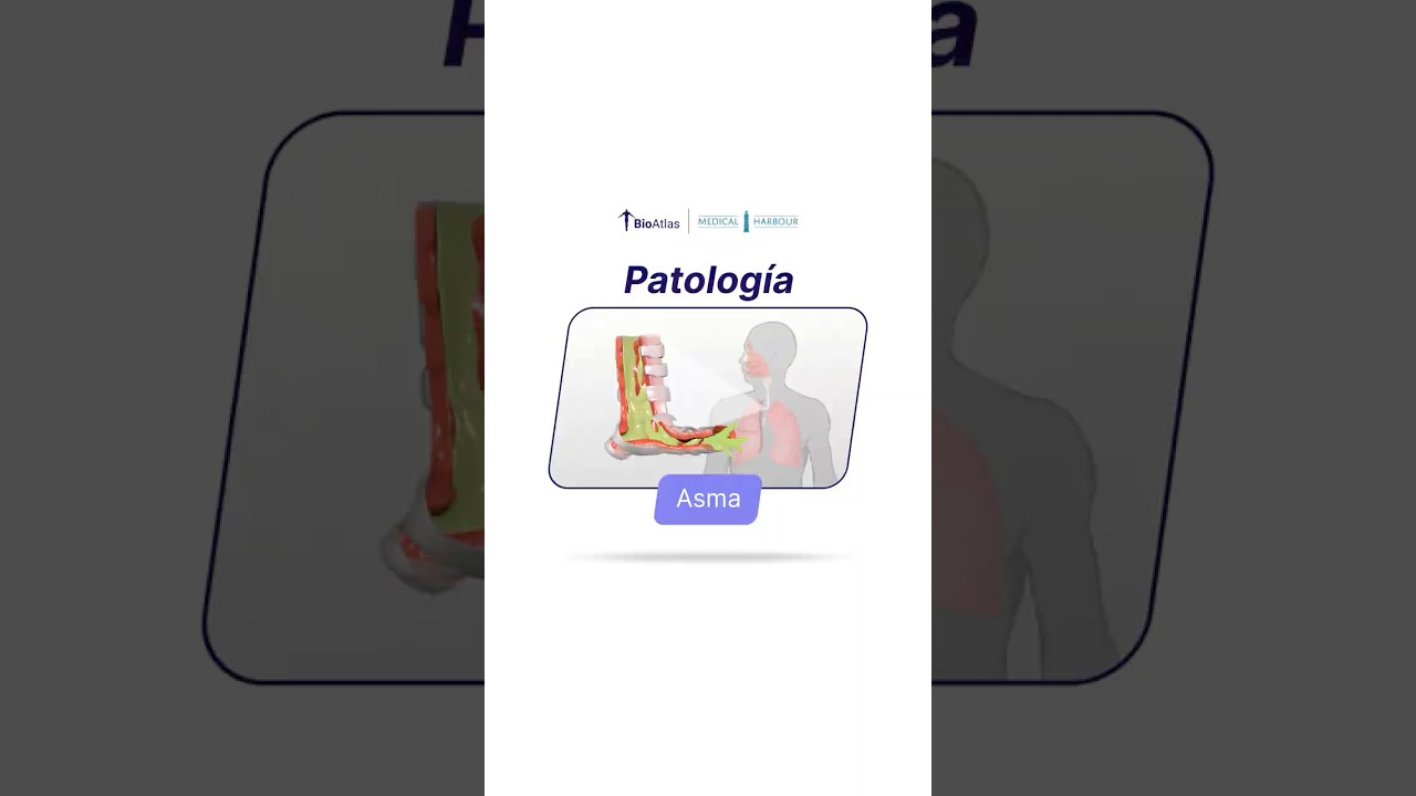 Asma | Patología | BioAtlas