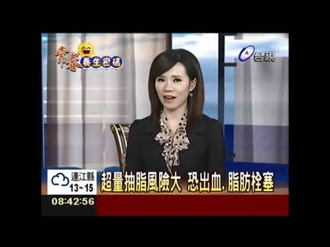 甩掉肥肉 除贅肉抽脂雕塑好身材