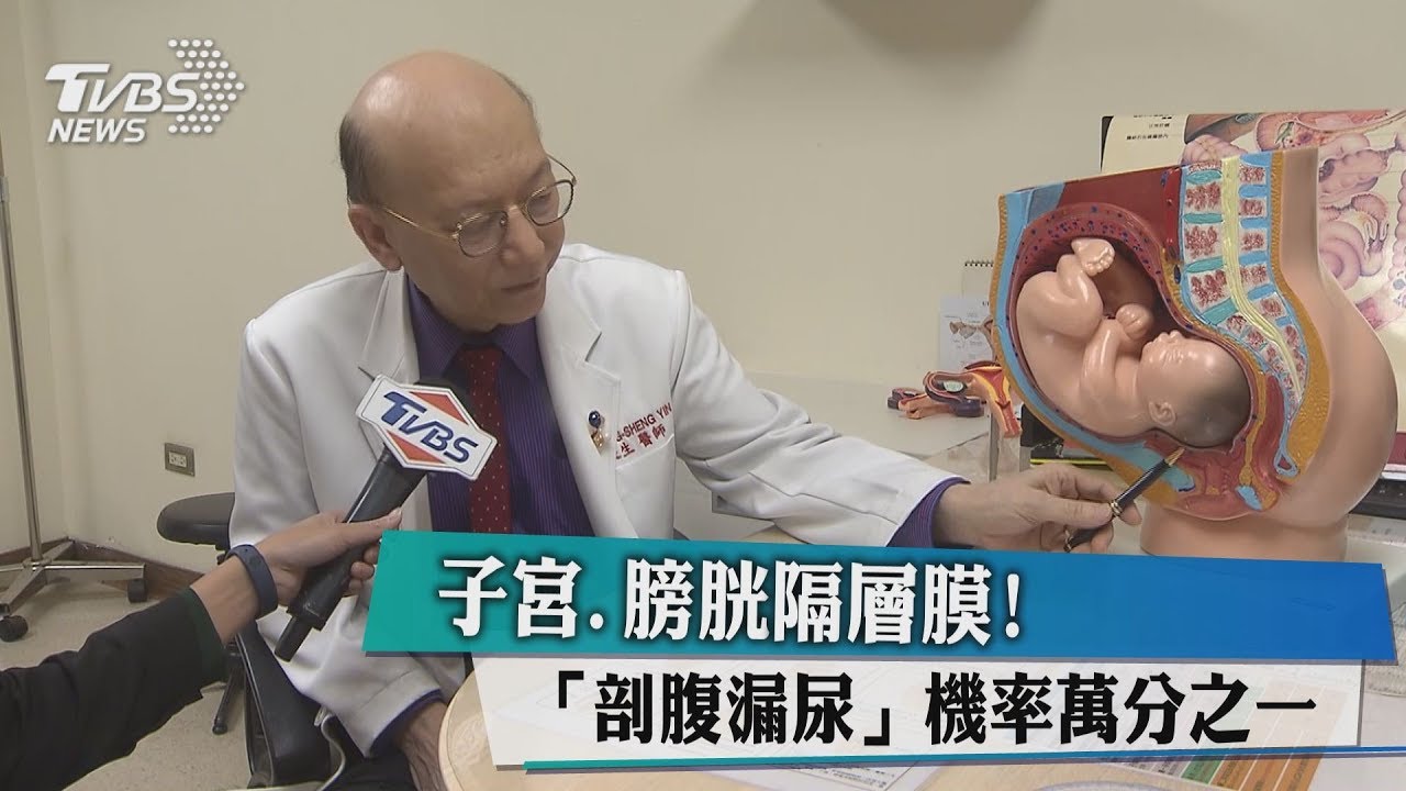 子宮、膀胱隔層膜！　「剖腹漏尿」機率萬分之一