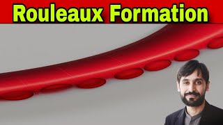 Rouleaux Formation | MLT Hub with kamran
