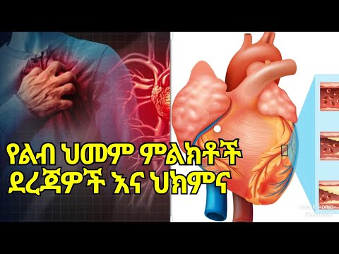 የልብ ህመም ምልክቶች ደረጃዎችና ህክምናቸው ከ ዶክተር አለ // levels of  Heart disease