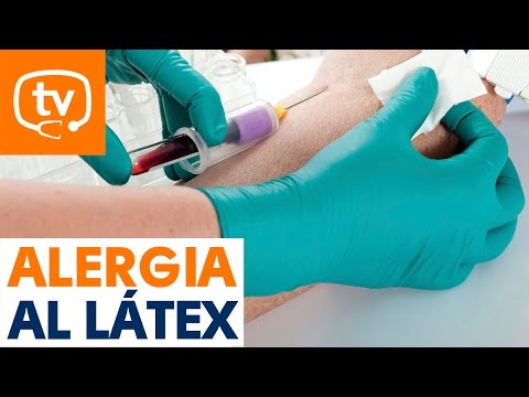 ¿En qué consiste la alergia al látex?