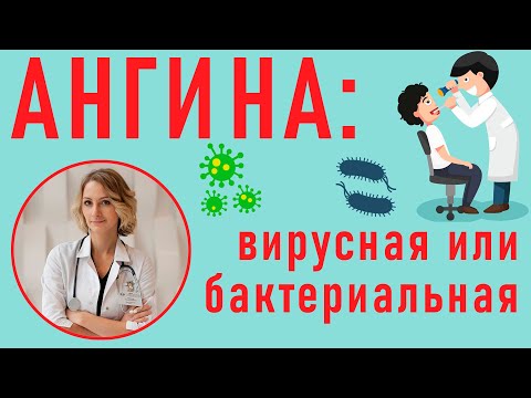 Ангины: вирусная и бактериальная