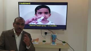 Otitis media with effusion (English) Patient teaching programme