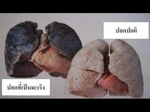 เชื้อโรคของความต้องการทางเพศสำหรับผู้หญิง ที่ผู้หญิงเวลาที่ตื่นเต้น