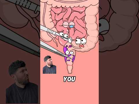 A stoma can be temporary or permanent, depending on the condition.