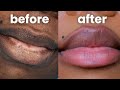 LIP TATTOO ON DARK LIPS 👄... DOES IT WORK? EVERYTHING YOU NEED TO KNOW!