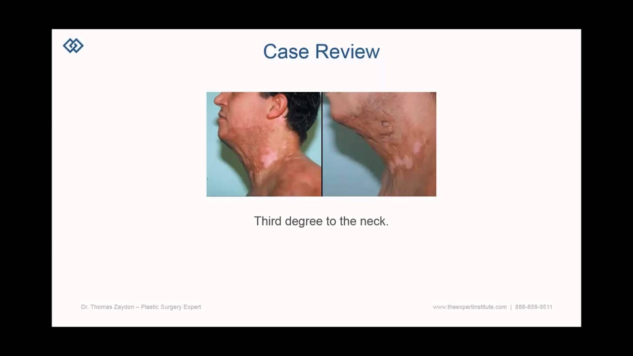 Fill out the form to watch