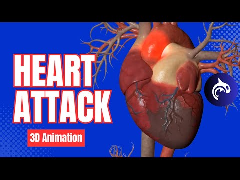 The Difference Between Cardiac Arrest Heart Attack and Heart Failure 3D Animation