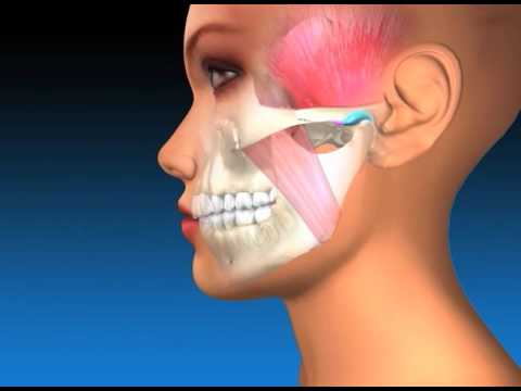TMJ Explanation & Therapy