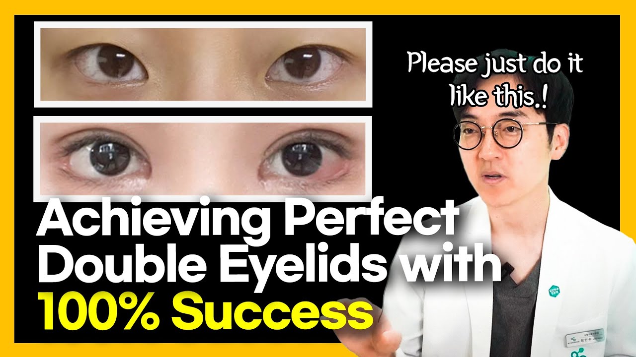 自然で美しい二重ラインを目指して