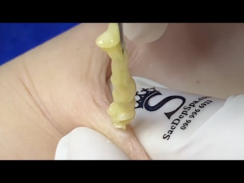 OMG is this Cheddar? So much squeezing!