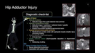 4-hip adductor injury