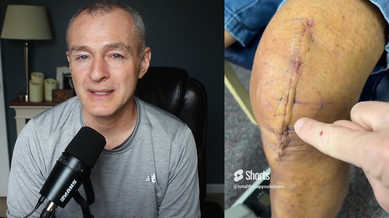 Worst Day After Knee Replacement